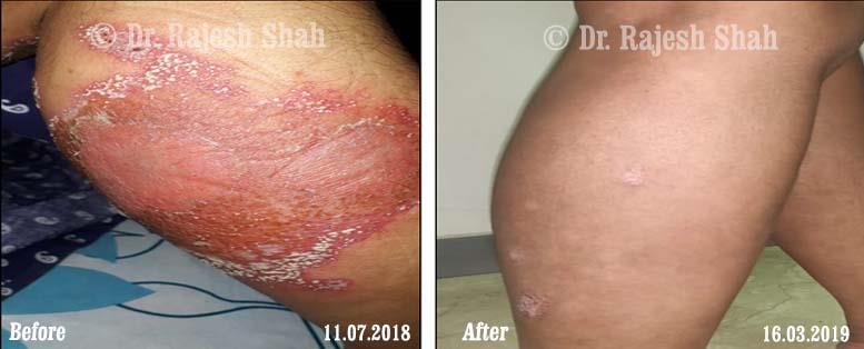 lifeforce homeopathy case-photos